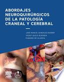 Abordajes Neuroquirúrgicos De La Patología Craneal Y Cerebral