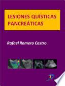 Lesiones Quísticas Pancreáticas