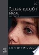 Reconstrucción Nasal